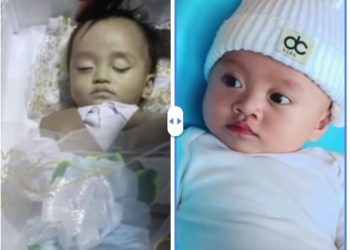 Bayi 11 Bulan Diduga Jadi Korban Malpraktik di RS Malalayang, Keluarga Tempuh Jalur Hukum