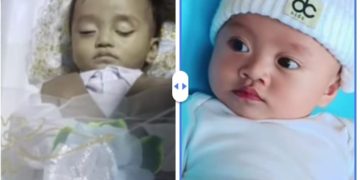 Bayi 11 Bulan Diduga Jadi Korban Malpraktik di RS Malalayang, Keluarga Tempuh Jalur Hukum